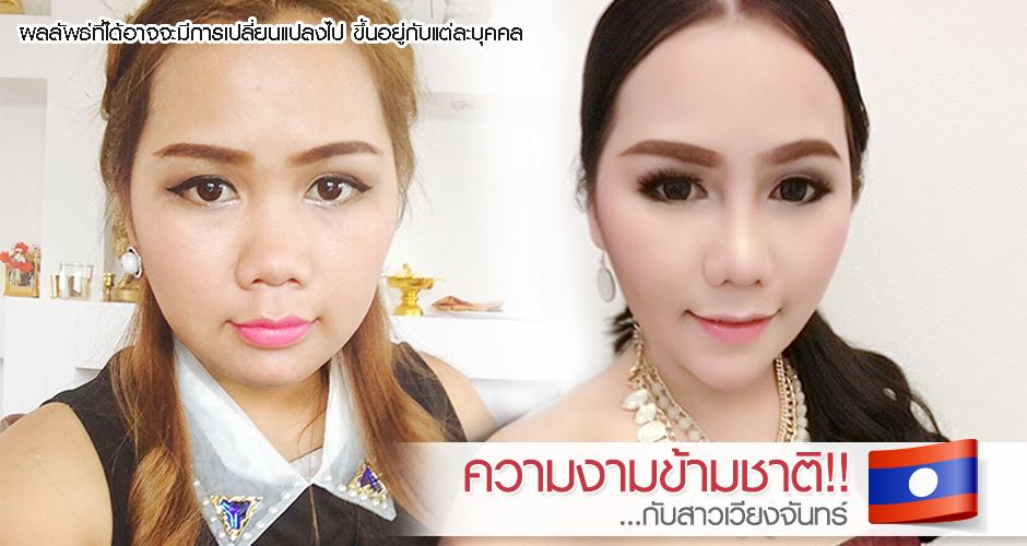 Beauty without boundaries! With ''a Vientiane woman''