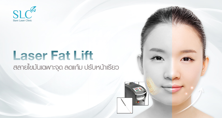 Laser Fat Lift